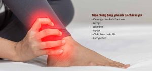 Triệu chứng bong gân như thế nào