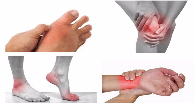 Đau khớp ngón chân thường là hậu quả của sự thay đổi mô do bàn chân bị biến dạng cơ học.