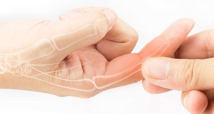 Viêm đau khớp ngón tay là một dạng bệnh lý thuộc chứng viêm khớp, gây ra vô số những bất tiện cho người mắc phải