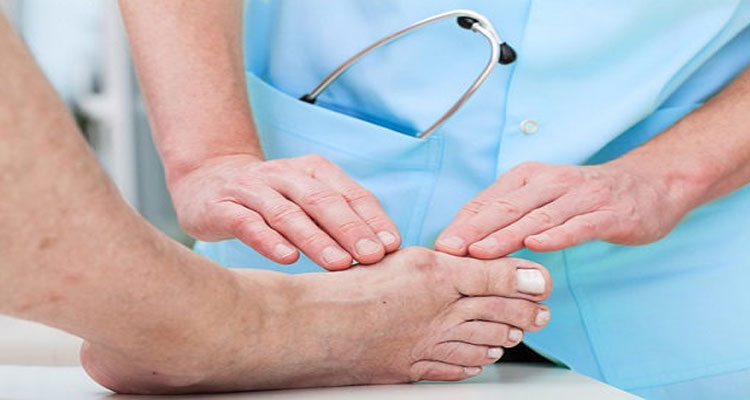 Đau khớp ngón chân cái là tình trạng ngón chân cái bị sưng nhức, tấy vùng khớp ngón chân cái.