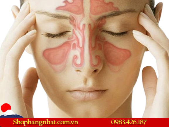 nguyên nhân gây bệnh viêm xoang